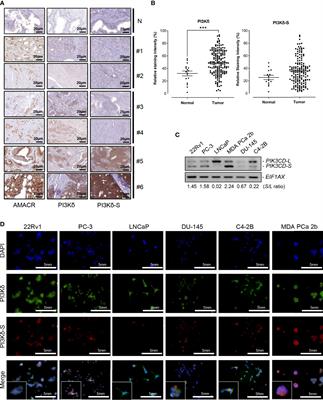 Aberrant PI3Kδ splice isoform as a potential biomarker and novel therapeutic target for endocrine cancers